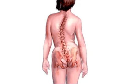 Causas del desarrollo de la osteocondrosis cervical