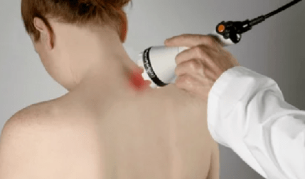 Tratamiento de la enfermedad osteocondral cervical a través de fisioterapia