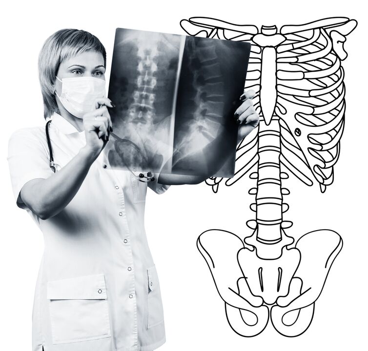Radiografía de la columna lumbar