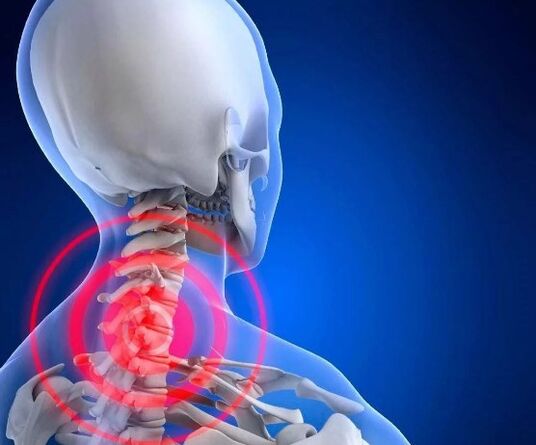 Hueso del cuello y condropatía