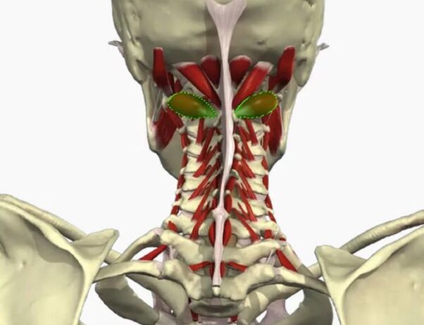Síndrome arterial conducido